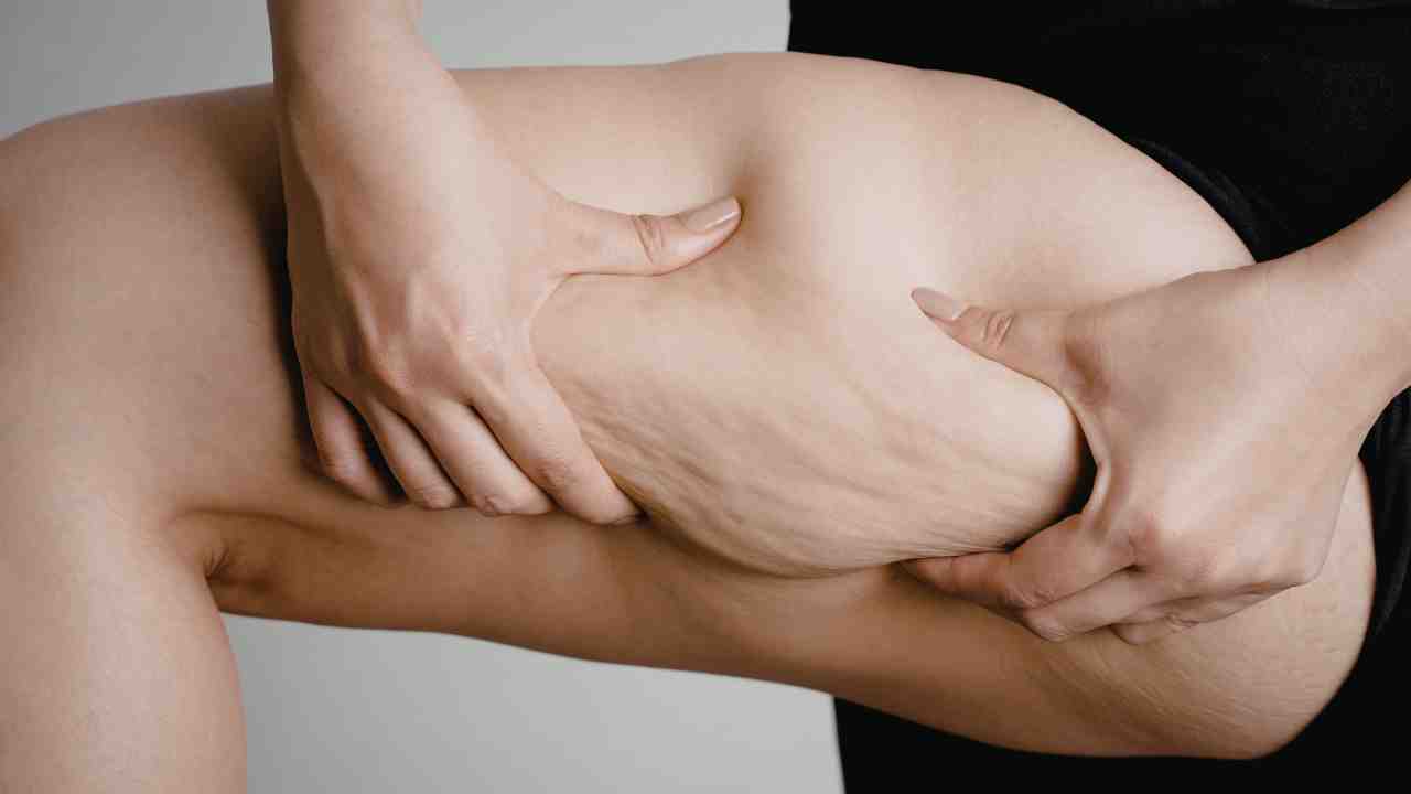 Pelle a buccia d'arancia cosa mangiare - Adorabile.it